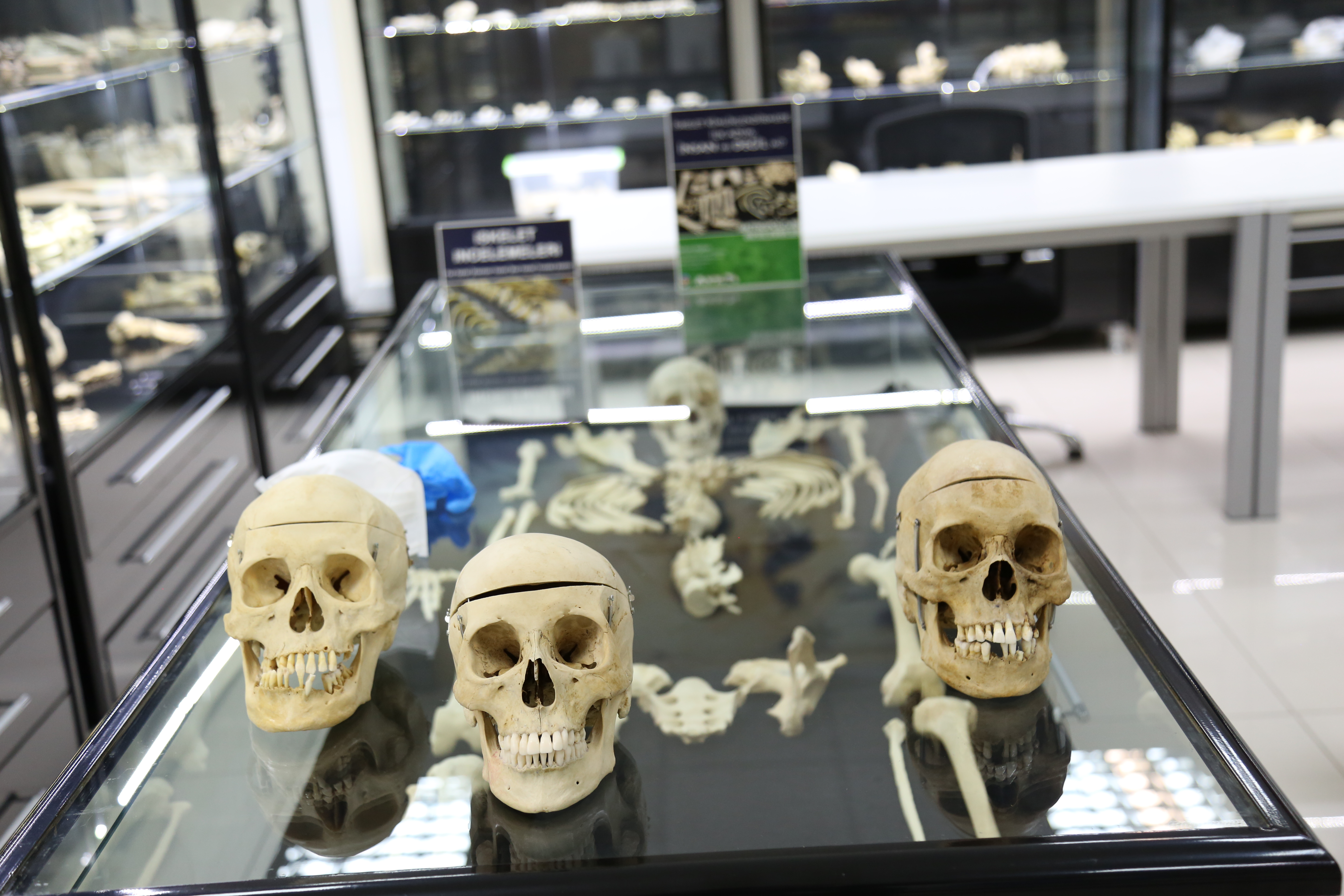 Karmaşık Cinayetler Antropoloji Laboratuvarında Aydınlatılıyor